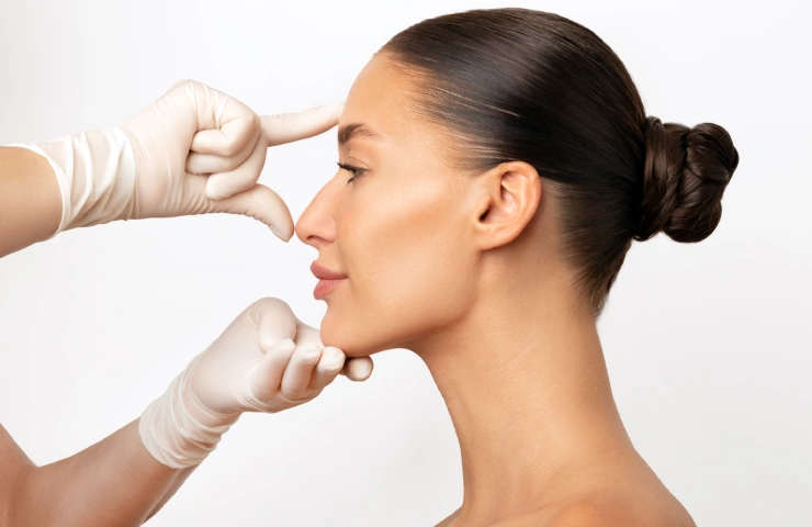Nose Contouring Without Surgery: The Rise of Nasal Dermal Fillers