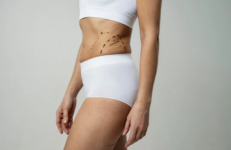 What Is Fat Grafting and How Does It Work?