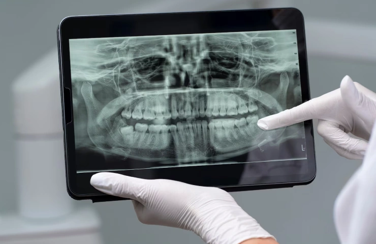 The Importance of CT Scans in Maxillofacial Surgery: Key Benefits, Alternatives, and Guidelines