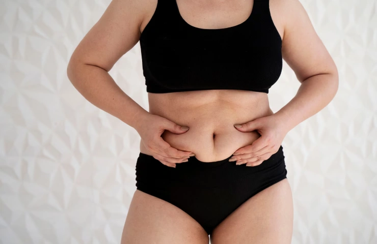 How a Tummy Tuck Can Transform Your Post-Pregnancy Body