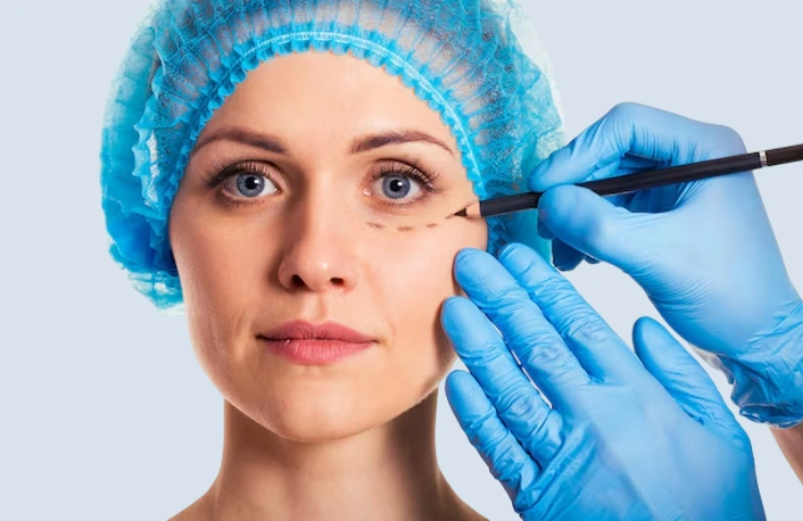 Blepharoplasty (Eyelid Surgery): The Complete Patient Guide