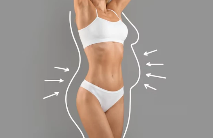 10 Common Questions About Liposuction Answered by Dr. Shilpi Bhadani
