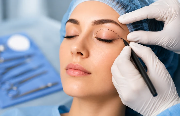 What Is Eyelid Surgery? Everything You Need to Know