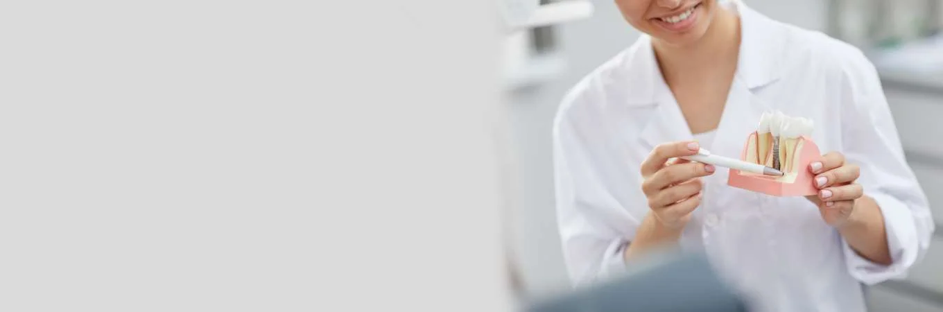 Immediate Dental Implants