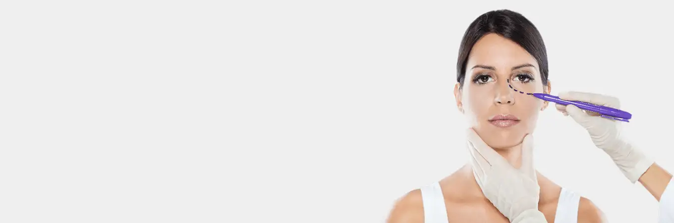 blepharoplasty surgery in India