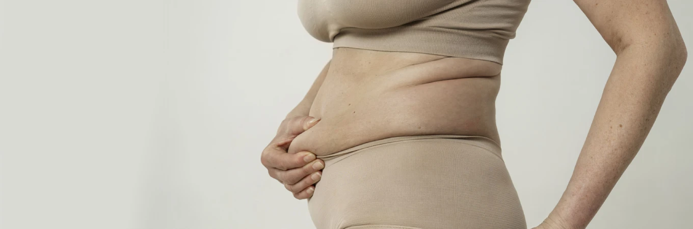Tummy Surgery Tuck in Ranchi