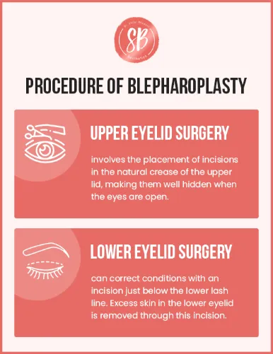 Blepharoplasty surgery in Delhi: SB Aesthetics offers eyelid surgery to enhance the appearance of eyelids. Procedures include upper and lower eyelid surgery.