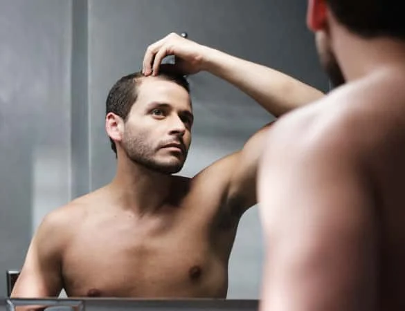 Hair Transplant in Gurgaon