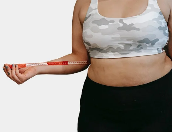 Abdominoplasty Surgery in Gurgaon