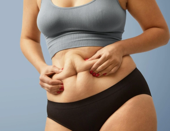 Tummy Tuck Surgery in Panipat
