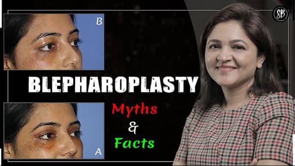 Blepharoplasty Eyelid Surgery Explained by Dr Shilpi Bhadani