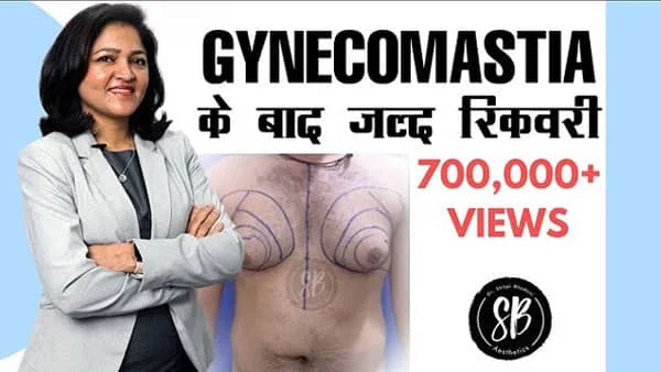 Gynecomastia