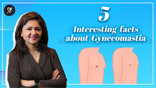 5 Facts about Gynecomastia Surgery | Gynecomastia Treatment | Male Breas-t Reduction | Dr. Shilpi