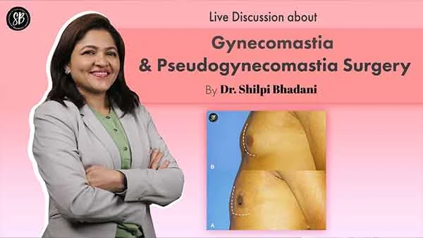 Live Discussion about Gynecomastia and Pseudogynecomastia Surgery with Dr. Shilpi Bhadani