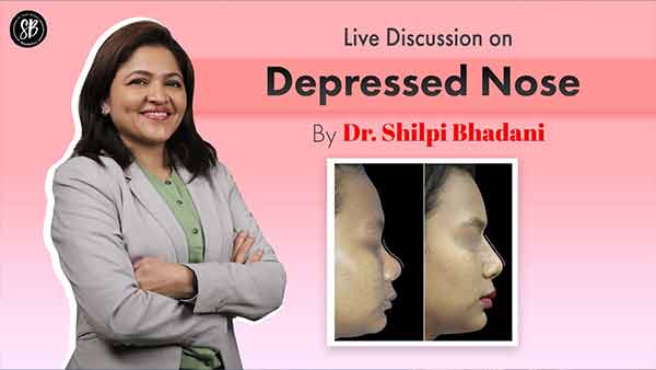 Live discussion on Depressed Nose | Treatment with Rhinoplasty or Nose Job | Dr. Shilpi Bhadani
