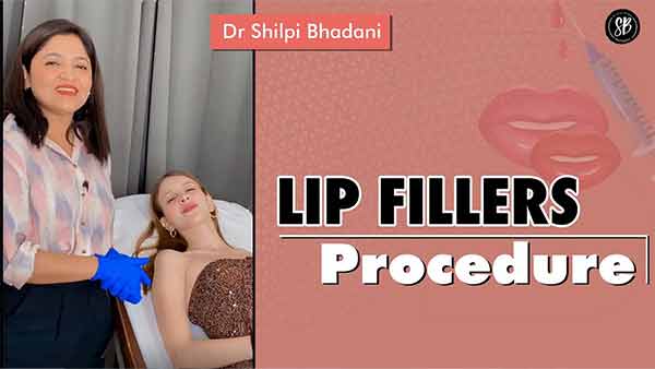 GET Beautiful Lip with Lip Fillers Surgery | Lip Fillers Procedures | Lip Enhancement Treatment