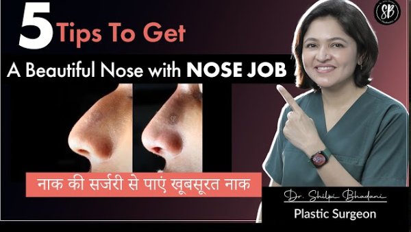 5 Tips To Get A Beautiful Nose with Nose Job/Rhinoplasty Surgery (नाक की सर्जरी से पाएं खूबसूरत नाक)
