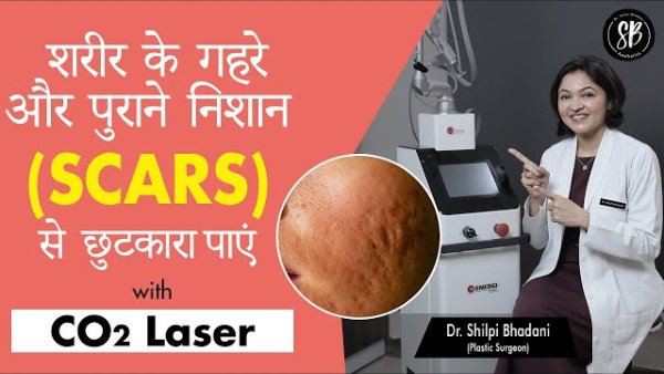 How to reduce deep and old body scars? (शरीर के गहरे और पुराने निशान को कैसे कम करें) | Dr. Shilpi