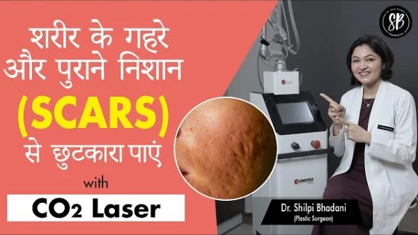 How to reduce deep and old body scars? (शरीर के गहरे और पुराने निशान को कैसे कम करें) | Dr. Shilpi