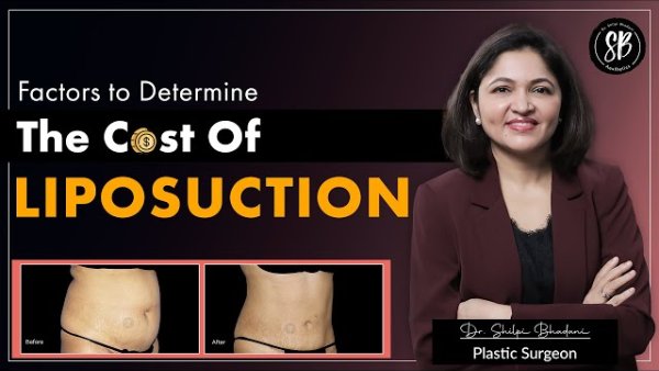 What is the cost of liposuction surgery in India? Important points to determine liposuction cost