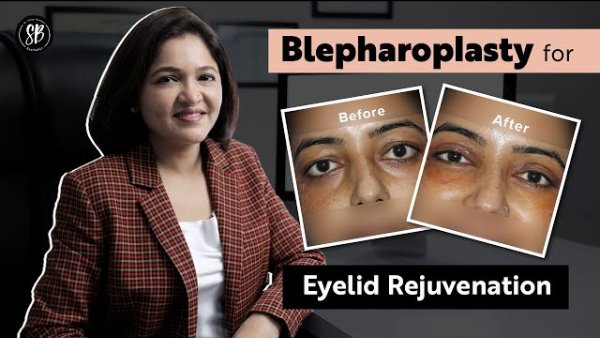 All about Blepharoplasty: Under eye bags, Puffy eyes, Droopy eyelids | Dr. Shilpi Bhadani
