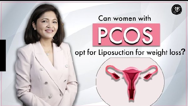 Can PCOS patients opt for weight loss surgery? Liposuction for women with PCOS | Dr. Shilpi Bhadani