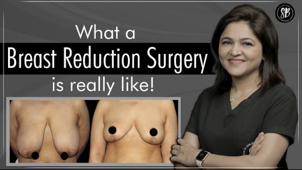 How to Reduce Breas-t Fat? | Breas-t Reduction Surgery | The Ultimate Solution for Heavy Breas-ts