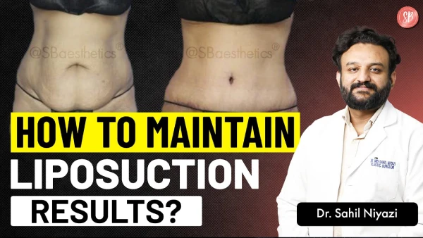 How To Maintain Liposuction Results? | Liposuction Aftercare Tips | Dr. Sahil Niyazi | SB Aesthetics