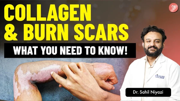 How Collagen Heals Burn Scars | Role of Collagen in Scar Healing | Dr. Sahil Niyazi | SB Aesthetics