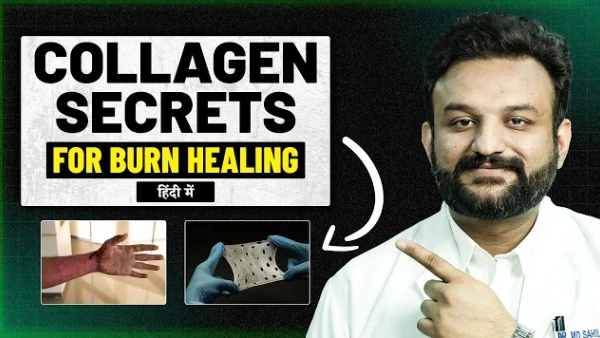 Burn Injury और Scar में Collagen का चौंकाने वाला सच | जल्दी Healing के लिए जानें Expert Tips