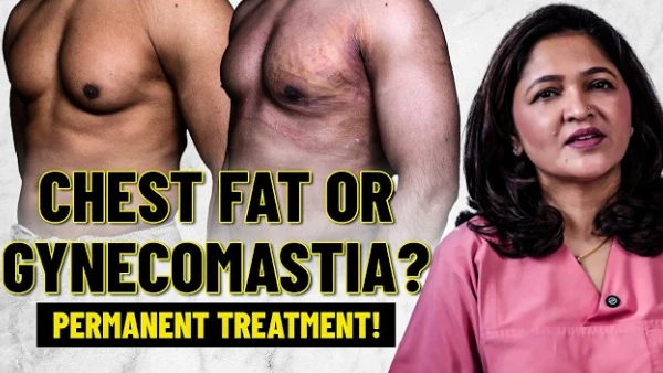 Gynecomastia vs Chest Contouring Surgery: असली अंतर क्या है? |Liposuction or Gland Removal Explained