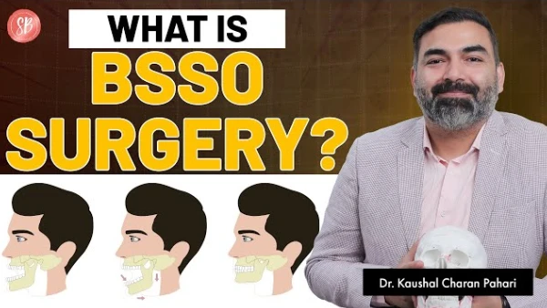 चेहरे का संतुलन सुधारें | Jaw Alignment Surgery | BSSO सर्जरी क्या है? | Best Jaw surgery in India