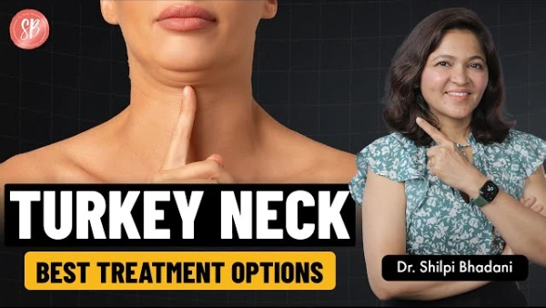 Get Rid of Double Chin & Sagging Neck | V Face Shape Surgery | Tech Neck | Dr Shilpi Bhadani