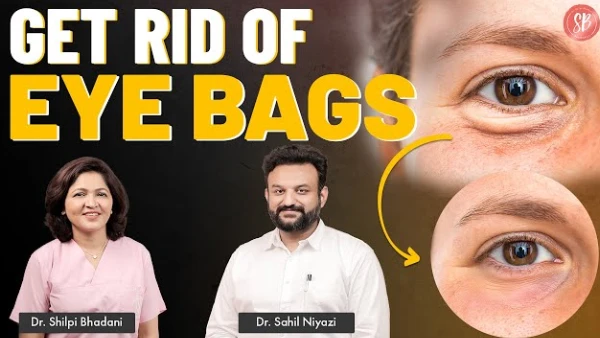 How to Get Rid of Eye Bags? | Eye Bags Treatment | Dr. Shilpi & Dr. Sahil | SB Aesthetics