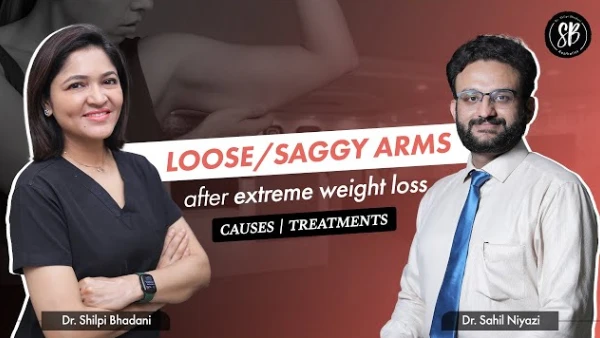 Get Rid of Loose & Saggy arms | Tighten loose skin | Liposuction Surgery in Gurgaon