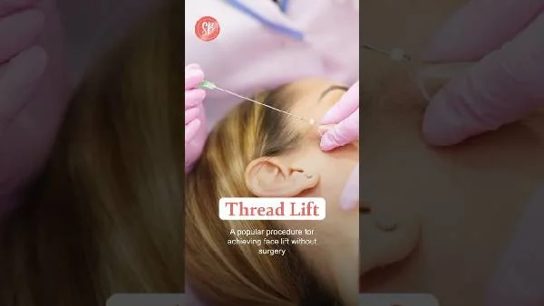 Thread Lift