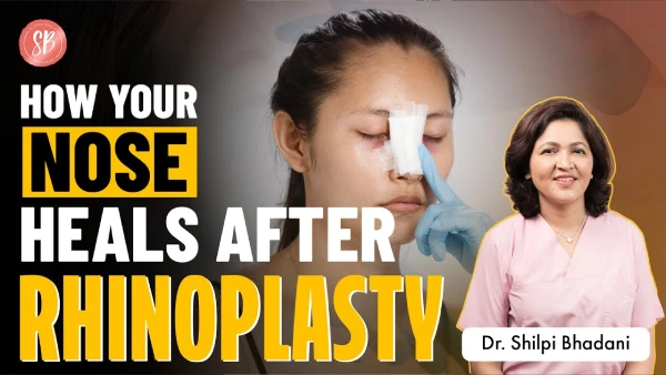Rhinoplasty