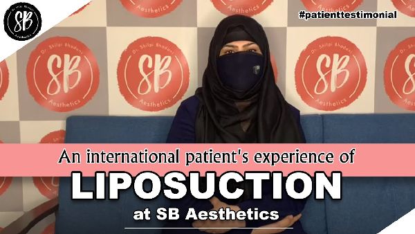 An International patient's experience of Liposuction - SB Aesthetics