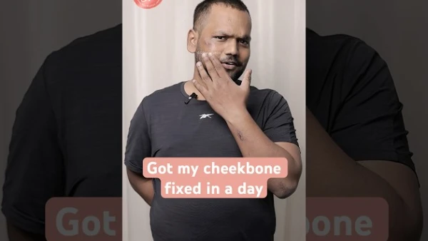 Got My Cheekbone Fixed in a Day