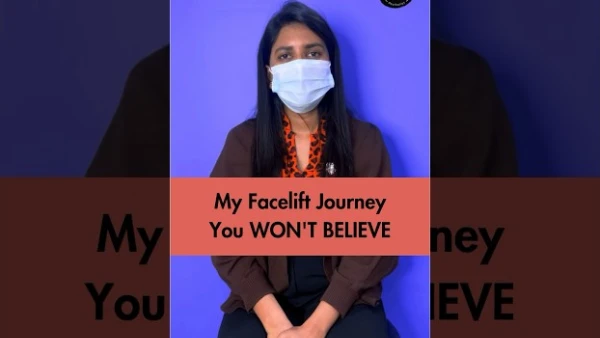 My Facelift Experience | SB Aesthetics| Facelift Surgery Clinic in Gurgaon