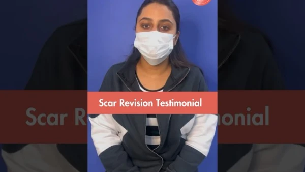 Scar revision surgery | Patient testimonial | Best Plastic Surgery clinic in Delhi NCR
